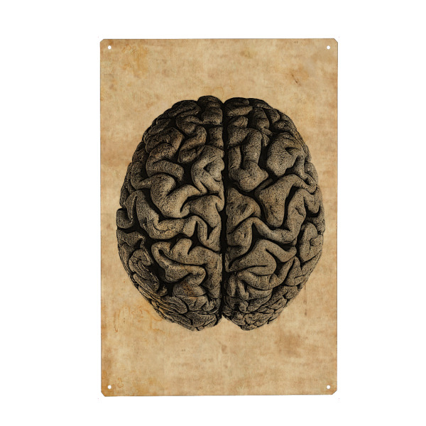 Holzbild "Anatomie des Gehirns" artboxONE - Menschen - Anatomie des gehirns,Anatomie,Gehirn,Medizin,Physikum,Pathologie,Schädel,Mensch